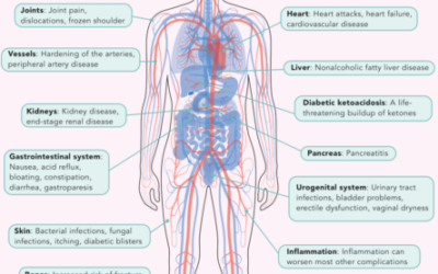 A Full-Body Disease: Complications That Can Accompany Diabetes