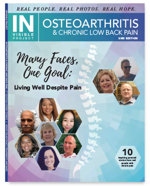 Osteoarthritis and Chronic Low Back Pain-2nd Edition