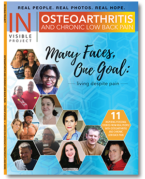 Osteoarthritis and Chronic Low Back Pain